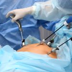 Mastering the Art of Laparoscopic Training Techniques and Benefits